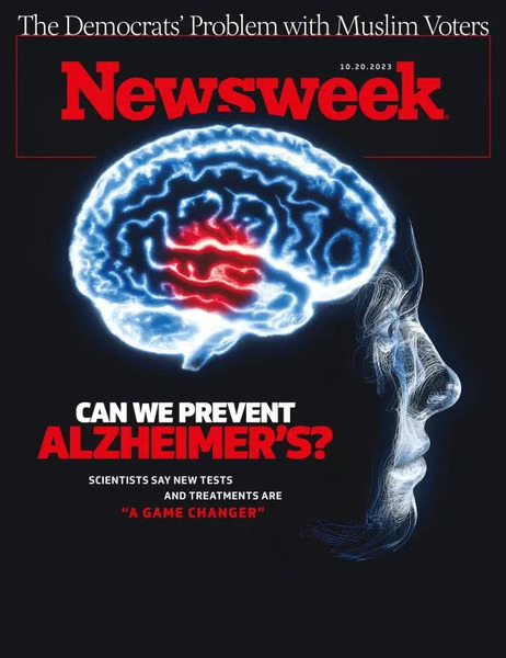 阿茲海默新療法現曙光 副作用遭忽略（新聞周刊 Newsweek）